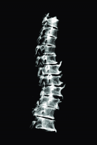 Radiograph-of-the-T2-T12-thoracic-vertebrae-norma-lateralis-Note-the-ossification-at[1]